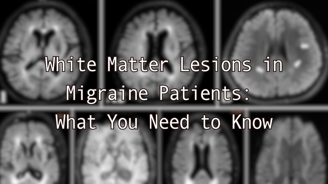 White Matter Lesions in Migraine Patients: What You Need to Know